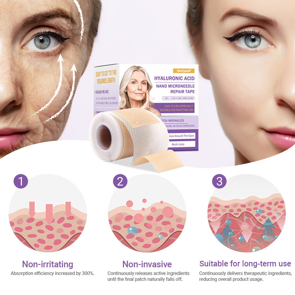 ✅Official Store | Ourlyard® Hyaluronic Acid Nano Microneedle Repair Tape ❤️(Repairs wrinkles, fine lines, skin laxity, etc., suitable for multiple areas such as the face, hands, abdomen, legs – 1.6 inch x 59 inch roll)