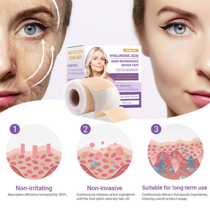 ✅Official Store | Ourlyard® Hyaluronic Acid Nano Microneedle Repair Tape ❤️(Repairs wrinkles, fine lines, skin laxity, etc., suitable for multiple areas such as the face, hands, abdomen, legs – 1.6 inch x 59 inch roll)