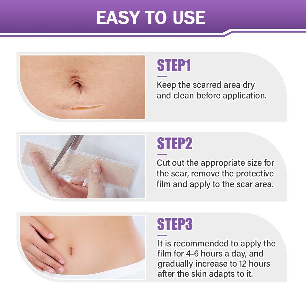 ✅Official Store |Ourlyard® Hyaluronic Acid Nano Microneedle Repair Tape❤️(Treatment of old and new scars, reduction of surgical scars, stretch marks, keloids, acne, burns, warts, dermatomes and varicose veins)