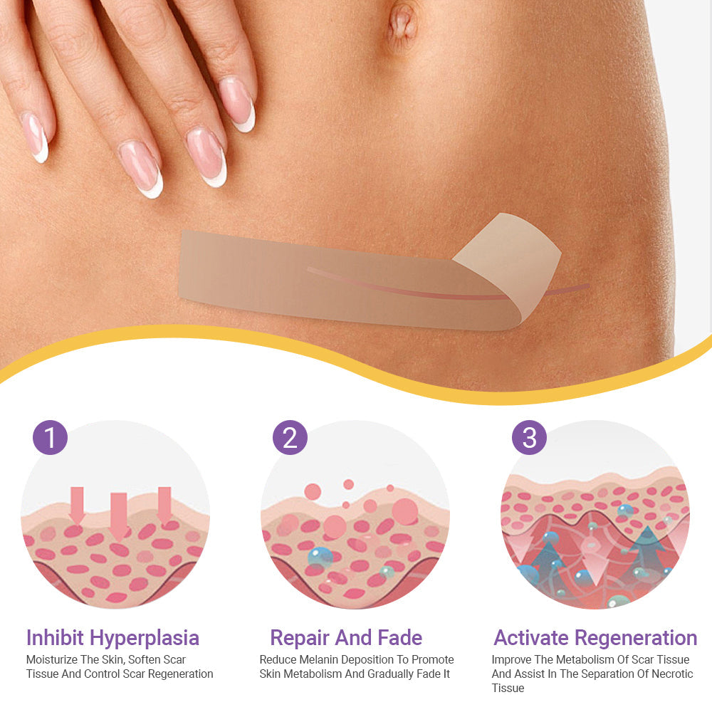 ✅Official Store |Ourlyard® Hyaluronic Acid Nano Microneedle Repair Tape❤️(Treatment of old and new scars, reduction of surgical scars, stretch marks, keloids, acne, burns, warts, dermatomes and varicose veins)