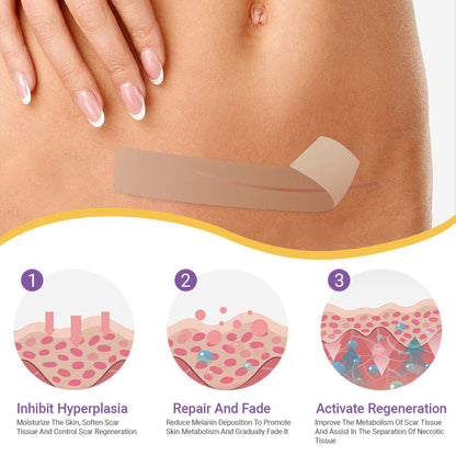 ✅Official Store |Ourlyard® Hyaluronic Acid Nano Microneedle Repair Tape❤️(Treatment of old and new scars, reduction of surgical scars, stretch marks, keloids, acne, burns, warts, dermatomes and varicose veins)