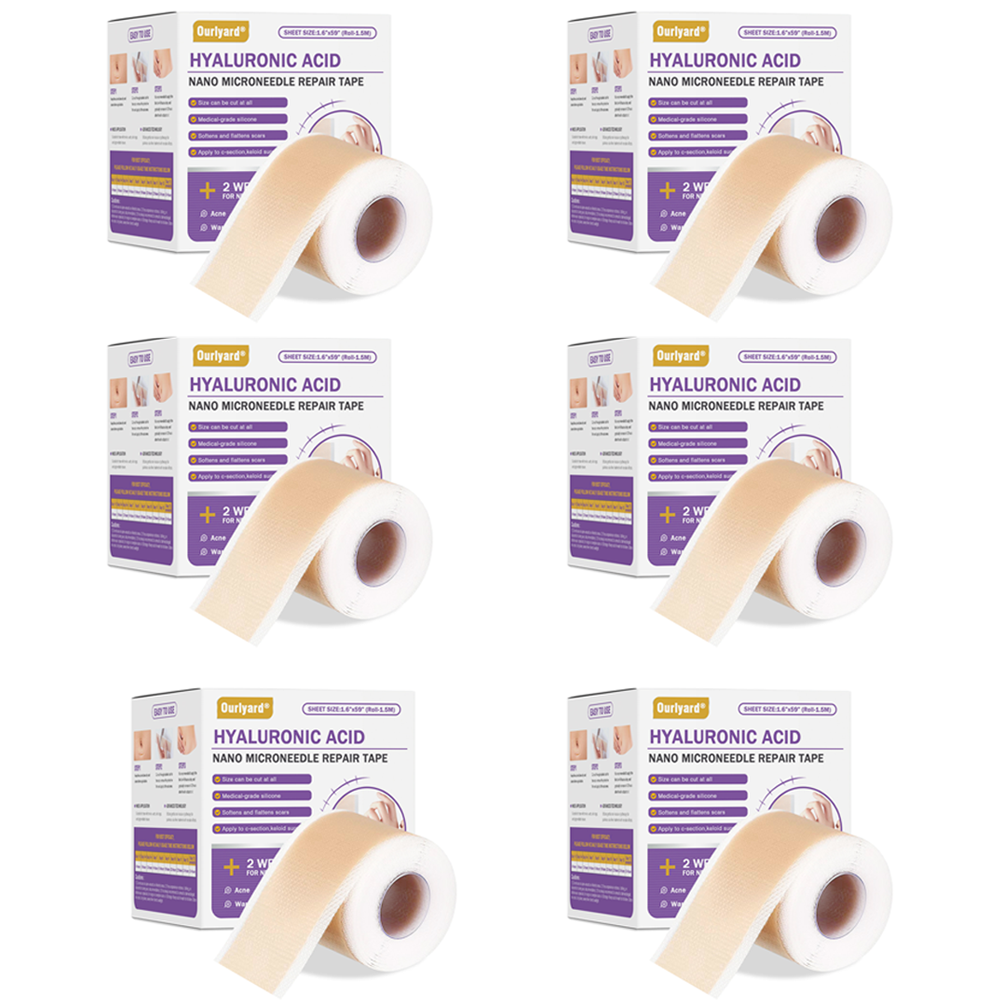 6 Rolls