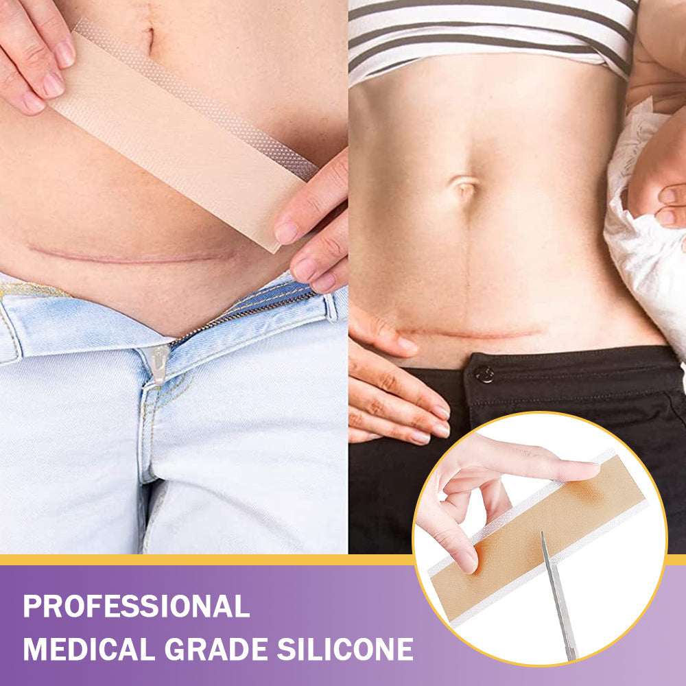 ✅Official Store |Ourlyard® Hyaluronic Acid Nano Microneedle Repair Tape❤️(Treatment of old and new scars, reduction of surgical scars, stretch marks, keloids, acne, burns, warts, dermatomes and varicose veins)